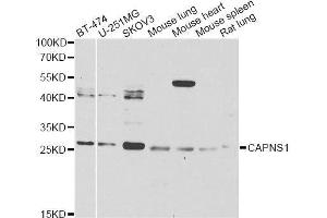 Western blot analysis of extracts of various cell lines, using CAPNS1 Antibody.