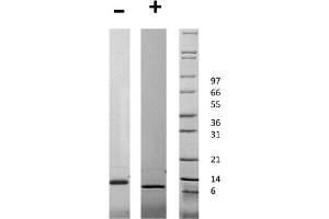 SDS-PAGE of Human Connective Tissue Growth Factor Recombinant Protein SDS-PAGE of Human Connective Tissue Growth Factor Recombinant Protein.