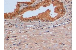 Immunohistochemistry (IHC) image for anti-Isocitrate Dehydrogenase 1 (NADP+), Soluble (IDH1) (AA 74-333) antibody (ABIN7436579)