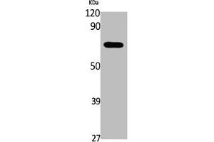 Western Blot analysis of K562, cells using Phospho-EpoR (Y426) Polyclonal Antibody (EPOR 抗体  (pTyr426))