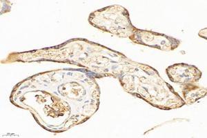 Immunohistochemistry analysis of paraffin-embedded humanplacentausing,ME2 (ABIN7074757) at dilution of 1:6000 (NAD-ME 抗体)