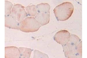 Detection of PFKP in Rat Skeletal muscle Tissue using Polyclonal Antibody to Phosphofructokinase, Platelet (PFKP) (PFKP 抗体  (AA 354-570))