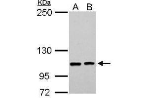 WB Image EPB41L3 antibody [C3], C-term detects EPB41L3 protein by Western blot analysis. (EPB41L3 抗体  (C-Term))