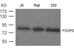 Western blot analysis of extract from JK, Raji and 293 cells using FOXP2 Antibody (FOXP2 抗体)