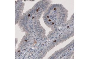 Immunohistochemical staining (Formalin-fixed paraffin-embedded sections) of human fallopian tube with CD8A monoclonal antibody, clone CL1529  shows strong positivity in a subset of lymphoid cells. (CD8 alpha 抗体  (AA 64-147))