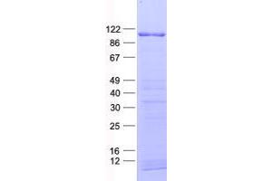ZNF750 Protein (His tag)