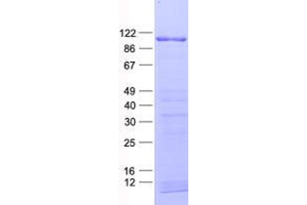 ZNF750 Protein (His tag)