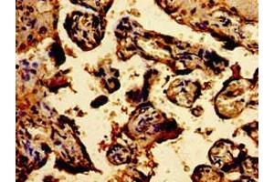 Immunohistochemistry of paraffin-embedded human placenta tissue using ABIN7172906 at dilution of 1:100 (TPT1 抗体  (AA 1-172))
