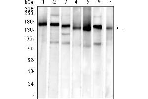 Western Blotting (WB) image for anti-MutS Homolog 6 (E. Coli) (MSH6) (AA 374-540) antibody (ABIN7193706)