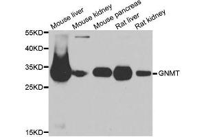 Western blot analysis of extracts of various cell lines, using GNMT antibody. (GNMT 抗体  (AA 1-295))