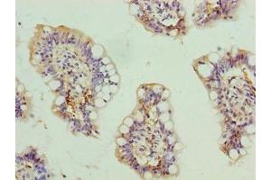Immunohistochemistry of paraffin-embedded human small intestine tissue using ABIN7168606 at dilution of 1:100 (SCARA3 抗体  (AA 201-466))
