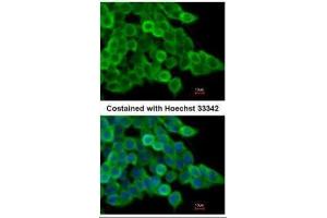 Immunofluorescence (IF) image for anti-Actin, alpha 2, Smooth Muscle, Aorta (ACTA2) (N-Term) antibody (ABIN2857027)