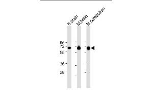 Western Blotting (WB) image for anti-Solute Carrier Family 1 (Glial High Affinity Glutamate Transporter), Member 3 (SLC1A3) (AA 127-161) antibody (ABIN6242871)