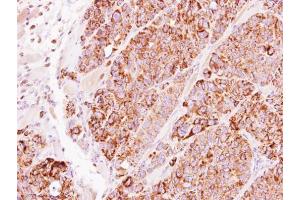 IHC-P Image Immunohistochemical analysis of paraffin-embedded SW480 xenograft, using TBRG4, antibody at 1:500 dilution. (TBRG4 抗体)