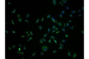 Immunofluorescence staining of SH-SY5Y cells with ABIN7139960 at 1:100, counter-stained with DAPI. (OR1K1 抗体  (AA 259-272))