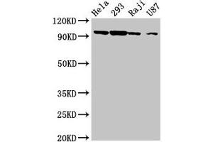 Western Blot Positive WB detected in: Hela whole cell lysate, 293 whole cell lysate, Raji whole cell lysate, U87 whole cell lysate All lanes: MASTL antibody at 6. (MASTL 抗体  (AA 612-740))