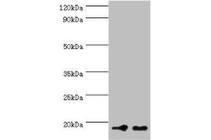Western blot All lanes: NCBP2 antibody at 5 μg/mL Lane 1: Hela whole cell lysate Lane 2: NIH/3T3 whole cell lysate Secondary Goat polyclonal to rabbit at 1/10000 dilution Predicted band size: 19, 16, 12 kDa Observed band size: 19 kDa (NCBP2 抗体  (AA 1-156))