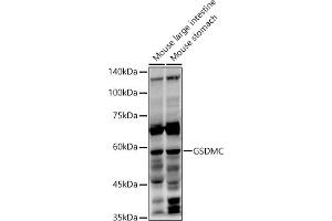 Western blot analysis of extracts of various cell lines, using GSDMC antibody (ABIN7268463) at 1:1000 dilution. (MLZE 抗体  (AA 1-100))