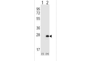 Western blot analysis of HPRT1 (arrow) using rabbit polyclonal HPRT1 Antibody (N-term) (ABIN652234 and ABIN2840981). (HPRT1 抗体  (N-Term))
