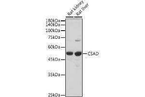 Western blot analysis of extracts of various cell lines, using CSAD antibody (ABIN6133497, ABIN6139087, ABIN6139088 and ABIN6217983) at 1:5000 dilution. (CSAD 抗体  (AA 371-520))