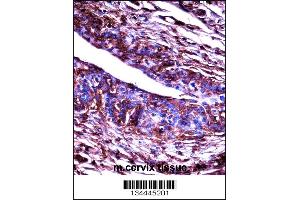 Mouse Adrbk2 Antibody immunohistochemistry analysis in formalin fixed and paraffin embedded mouse cervix tissue followed by peroxidase conjugation of the secondary antibody and DAB staining.