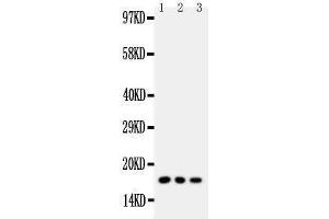 Western Blotting (WB) image for anti-Caveolin 2 (CAV2) (AA 1-17), (N-Term) antibody (ABIN3042683) (Caveolin 2 抗体  (N-Term))