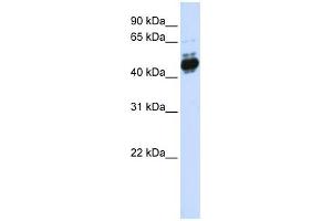 Western Blotting (WB) image for anti-Transcription Factor AP-2 beta (Activating Enhancer Binding Protein 2 Beta) (TFAP2B) (N-Term) antibody (ABIN2774206)