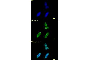 Histone H3 acetyl Lys9 antibody tested by immunofluorescence. (Histone 3 抗体  (acLys9))