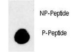 Dot blot analysis of phospho-LC3B antibody.