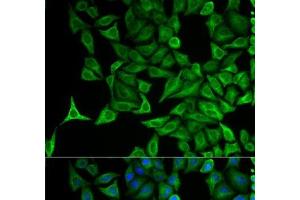Immunofluorescence analysis of HeLa cells using KRT20 Polyclonal Antibody (KRT20 抗体)