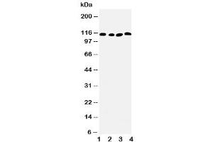 Western blot testing of SERCA2 ATPase antibody and Lane 1:  rat skeletal muscle (SERCA2 ATPase (Middle Region) 抗体)