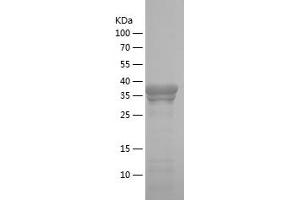 Western Blotting (WB) image for Metadherin (MTDH) (AA 168-298) protein (His-IF2DI Tag) (ABIN7282086) (MTDH Protein (AA 168-298) (His-IF2DI Tag))