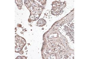 Immunohistochemistry of paraffin-embedded human placenta using MEF2C antibody (ABIN6132345, ABIN6143716, ABIN6143717 and ABIN6215998) at dilution of 1:100 (40x lens). (MEF2C 抗体  (AA 170-380))