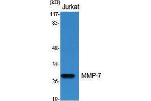 Western Blot (WB) analysis of specific cells using MMP-7 Polyclonal Antibody. (MMP7 抗体  (C-Term))