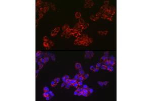 Immunofluorescence analysis of HepG2 cells using  Rabbit mAb (ABIN7265367) at dilution of 1:100 (40x lens). (ACAA2 抗体)