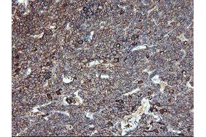 Image no. 5 for anti-C-Type Lectin Domain Family 4, Member E (CLEC4E) antibody (ABIN1497530)