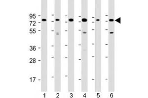 Western blot testing of human 1) Daudi, 2) HepG2, 3) Jurkat, 4) K562, 5) MOLT-4 and 5) Raji cell lysate with PABPC3 antibody at 1:2000. (PABPC3 抗体  (AA 84-117))