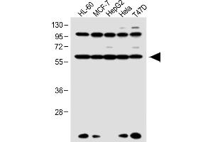 All lanes : Anti-RARA Antibody (C-term) at 1:1000 dilution Lane 1: HL-60 whole cell lysate Lane 2: MCF-7 whole cell lysate Lane 3: HepG2 whole cell lysate Lane 4: Hela whole cell lysate Lane 5: T47D whole cell lysate Lysates/proteins at 20 μg per lane. (Retinoic Acid Receptor alpha 抗体  (C-Term))