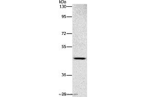 Western blot analysis of Human placenta tissue, using SIGLEC6 Polyclonal Antibody at dilution of 1:1000 (SIGLEC6 抗体)
