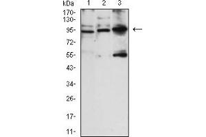 Western Blotting (WB) image for anti-Neural Cell Adhesion Molecule 1 (NCAM1) antibody (ABIN7193604)