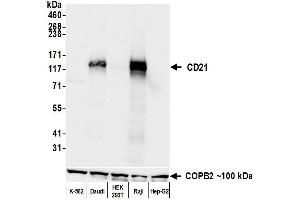 Western Blotting (WB) image for anti-Complement Component (3d/Epstein Barr Virus) Receptor 2 (CR2) (C-Term) antibody (ABIN7795815)
