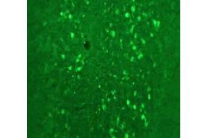 Immunofluorescence Microscopy of Anti-Calretinin (Sheep) Antibody Immunofluorescence Microscopy of Anti-Calretinin (Sheep) Antibody. (Calretinin 抗体)