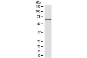 Western blot testing of human Jurkat lysate with CDC45 antibody at 0. (CDC45 抗体)