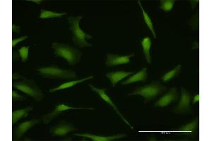Immunofluorescence of purified MaxPab antibody to MDM4 on HeLa cell. (MDM4-binding Protein 抗体  (AA 1-490))