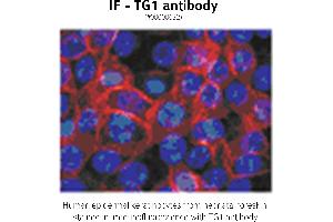 Image no. 1 for anti-Transglutaminase 1, Keratinocyte (TGM1) antibody (ABIN347015) (TGM1 抗体)