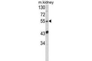 Western Blotting (WB) image for anti-Nucleotide Exchange Factor SIL1 (SIL1) antibody (ABIN3003781) (SIL1 抗体)