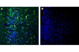 Expression of SEZ6 in mouse piriform cortex.