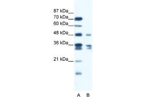 WB Suggested Anti-ZNF577 Antibody Titration:  1. (ZNF577 抗体  (C-Term))