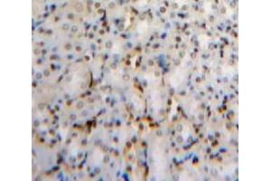 Used in DAB staining on fromalin fixed paraffin-embedded Kidney tissue (PHAP1 抗体  (AA 2-175))