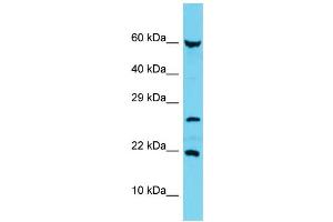 Host: Rabbit Target Name: C17orf102 Sample Type: MCF7 Whole Cell lysates Antibody Dilution: 1. (C17orf102 抗体  (Middle Region))
